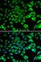 N(Alpha)-Acetyltransferase 10, NatA Catalytic Subunit antibody, 22-628, ProSci, Immunofluorescence image 