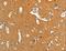 Adducin 2 antibody, LS-C401187, Lifespan Biosciences, Immunohistochemistry paraffin image 