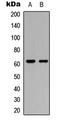Ceramide Kinase Like antibody, LS-C354605, Lifespan Biosciences, Western Blot image 