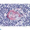 AKT Serine/Threonine Kinase 2 antibody, LS-C812493, Lifespan Biosciences, Immunohistochemistry paraffin image 