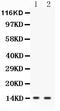 Gastrotropin antibody, PA2158, Boster Biological Technology, Western Blot image 