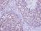 LIM Domain Kinase 2 antibody, LS-C186032, Lifespan Biosciences, Immunohistochemistry frozen image 