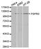 Fibroblast growth factor receptor 2 antibody, TA327257, Origene, Western Blot image 