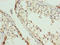 Eukaryotic Translation Initiation Factor 5A2 antibody, LS-C398414, Lifespan Biosciences, Immunohistochemistry paraffin image 