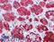Perilipin 2 antibody, LS-B4850, Lifespan Biosciences, Immunohistochemistry paraffin image 