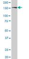 Rho Associated Coiled-Coil Containing Protein Kinase 2 antibody, H00009475-M02, Novus Biologicals, Western Blot image 