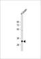 Nicotinamide Nucleotide Adenylyltransferase 1 antibody, 61-159, ProSci, Western Blot image 