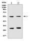 Erythropoietin Receptor antibody, A00427-2, Boster Biological Technology, Western Blot image 