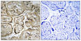 Cystatin 9 Like antibody, abx014403, Abbexa, Western Blot image 