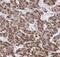 Prosaposin antibody, FNab06843, FineTest, Immunohistochemistry paraffin image 