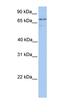 Transglutaminase 7 antibody, orb330573, Biorbyt, Western Blot image 