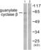 Guanylate cyclase soluble subunit beta-1 antibody, abx013101, Abbexa, Western Blot image 