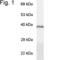 G Protein Subunit Alpha Transducin 1 antibody, PA1-724, Invitrogen Antibodies, Western Blot image 