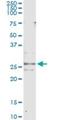 Cripto, FRL-1, Cryptic Family 1 antibody, H00055997-M09, Novus Biologicals, Immunoprecipitation image 