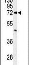 ATP Binding Cassette Subfamily D Member 2 antibody, PA5-26632, Invitrogen Antibodies, Western Blot image 