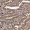 VPS37A Subunit Of ESCRT-I antibody, NBP1-83528, Novus Biologicals, Immunohistochemistry frozen image 