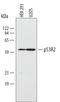 Ribonucleotide Reductase Regulatory TP53 Inducible Subunit M2B antibody, AF3788, R&D Systems, Western Blot image 