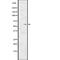 EPH Receptor A2 antibody, abx147168, Abbexa, Western Blot image 