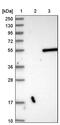 Carboxypeptidase A3 antibody, PA5-52588, Invitrogen Antibodies, Western Blot image 