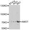 Angiomotin antibody, A8075, ABclonal Technology, Western Blot image 