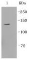 Integrin Subunit Alpha 6 antibody, NBP2-67311, Novus Biologicals, Western Blot image 