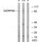 R3H Domain And Coiled-Coil Containing 1 Like antibody, A13305, Boster Biological Technology, Western Blot image 