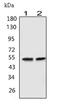 Gamma-Aminobutyric Acid Type A Receptor Alpha1 Subunit antibody, LS-C312732, Lifespan Biosciences, Western Blot image 