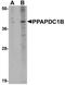 Phospholipid Phosphatase 5 antibody, A13059, Boster Biological Technology, Western Blot image 