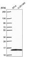 Nuclear Receptor 2C2 Associated Protein antibody, PA5-65965, Invitrogen Antibodies, Western Blot image 