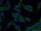 Mitochondrial Trans-2-Enoyl-CoA Reductase antibody, 14932-1-AP, Proteintech Group, Immunofluorescence image 