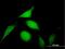 Proteasome 26S Subunit, Non-ATPase 14 antibody, H00010213-B02P, Novus Biologicals, Immunocytochemistry image 