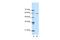 AT-Rich Interaction Domain 3A antibody, A03604, Boster Biological Technology, Western Blot image 