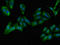 GIT ArfGAP 1 antibody, LS-C678073, Lifespan Biosciences, Immunofluorescence image 