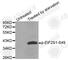 Eukaryotic Translation Initiation Factor 2 Subunit Alpha antibody, AP0341, ABclonal Technology, Western Blot image 