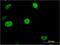 Cell Division Cycle 20B antibody, H00166979-M11, Novus Biologicals, Immunocytochemistry image 
