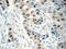 HNF1 Homeobox B antibody, 12533-1-AP, Proteintech Group, Immunohistochemistry paraffin image 