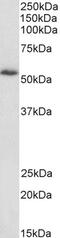 Drebrin Like antibody, PA5-18046, Invitrogen Antibodies, Western Blot image 