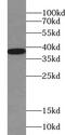 Vesicle Trafficking 1 antibody, FNab09460, FineTest, Western Blot image 