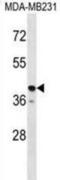 Taste 2 Receptor Member 31 antibody, abx028927, Abbexa, Western Blot image 