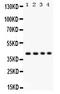 Matrix-remodeling-associated protein 2 antibody, PB9555, Boster Biological Technology, Western Blot image 