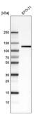 Integrin Subunit Beta 3 antibody, NBP2-76484, Novus Biologicals, Western Blot image 