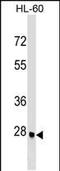 Arginine-Fifty Homeobox antibody, PA5-35190, Invitrogen Antibodies, Western Blot image 