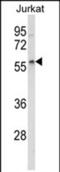 Sprouty Related EVH1 Domain Containing 1 antibody, PA5-71899, Invitrogen Antibodies, Western Blot image 