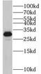 Thiamine Triphosphatase antibody, FNab08678, FineTest, Western Blot image 