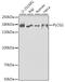 Phospholipase C Gamma 2 antibody, GTX32793, GeneTex, Western Blot image 