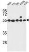 G Protein-Coupled Receptor 180 antibody, AP51925PU-N, Origene, Western Blot image 