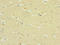 Sodium Voltage-Gated Channel Alpha Subunit 3 antibody, LS-C676460, Lifespan Biosciences, Immunohistochemistry paraffin image 