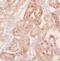 Kelch Like Family Member 20 antibody, FNab04618, FineTest, Immunohistochemistry paraffin image 