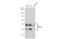 IKAROS Family Zinc Finger 1 antibody, GTX01051, GeneTex, Western Blot image 