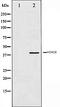 Histone Deacetylase 8 antibody, orb106525, Biorbyt, Western Blot image 